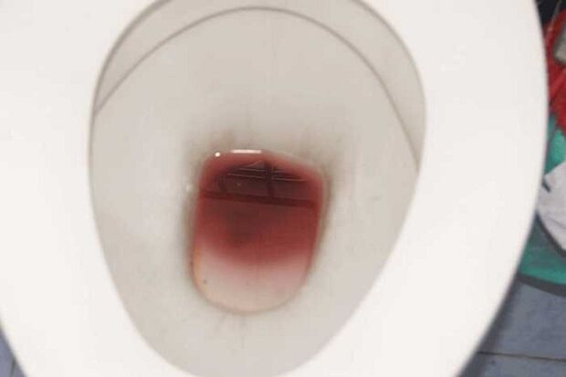 ظهور بقع عند الرجال عند استثارتهم